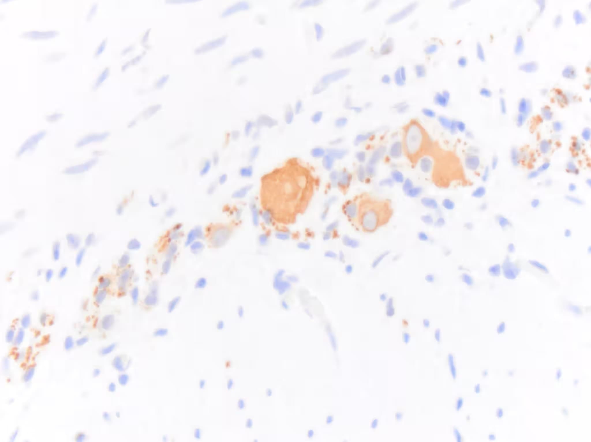 NF-H Antibody