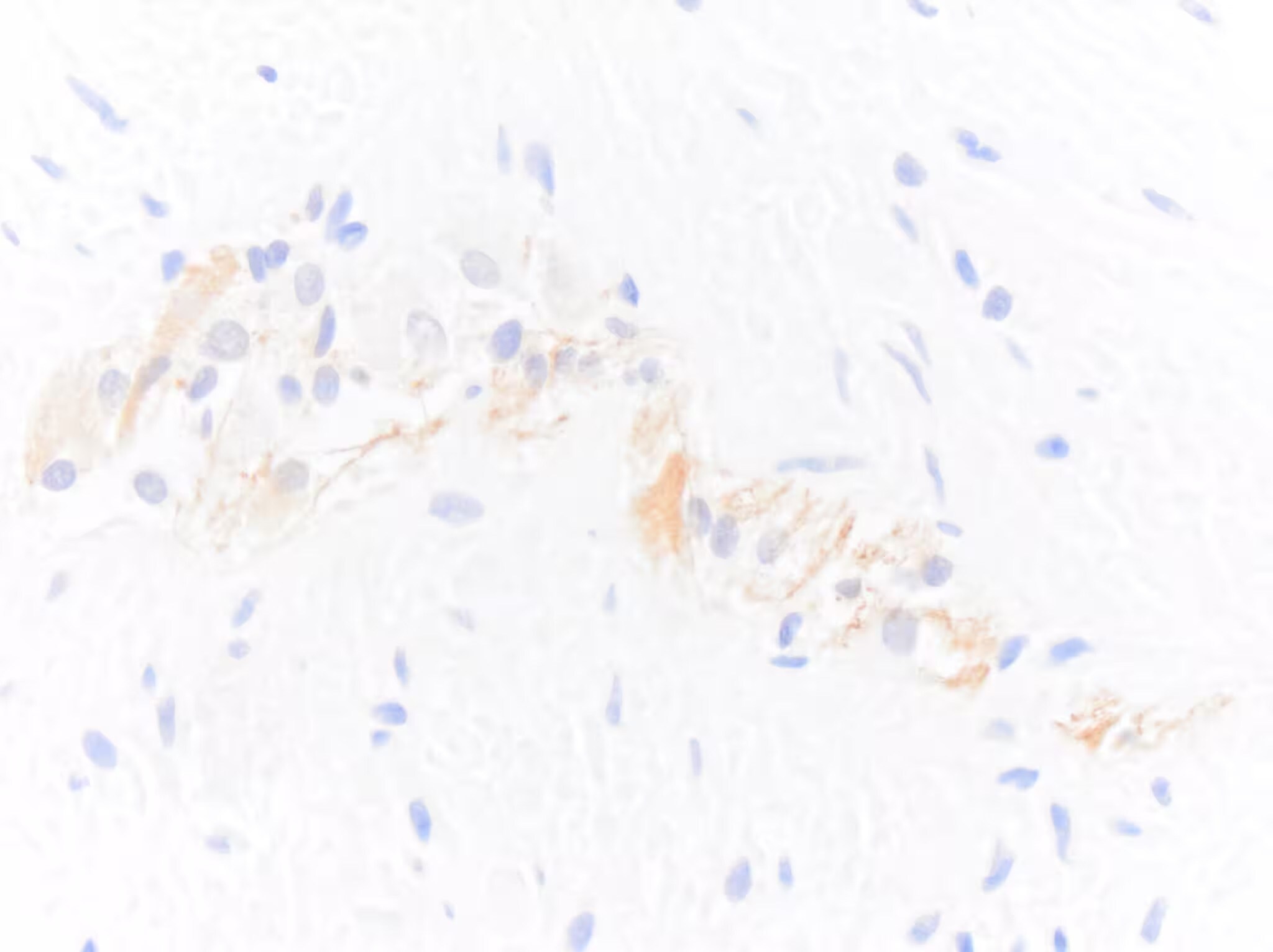 NF-H Antibody