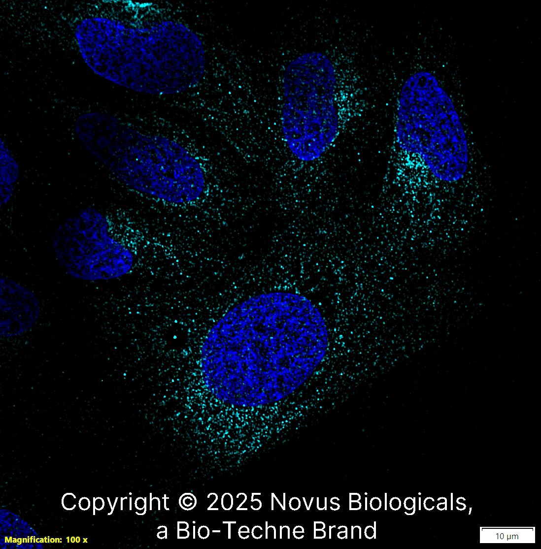 LRRK2 Antibody - BSA Free