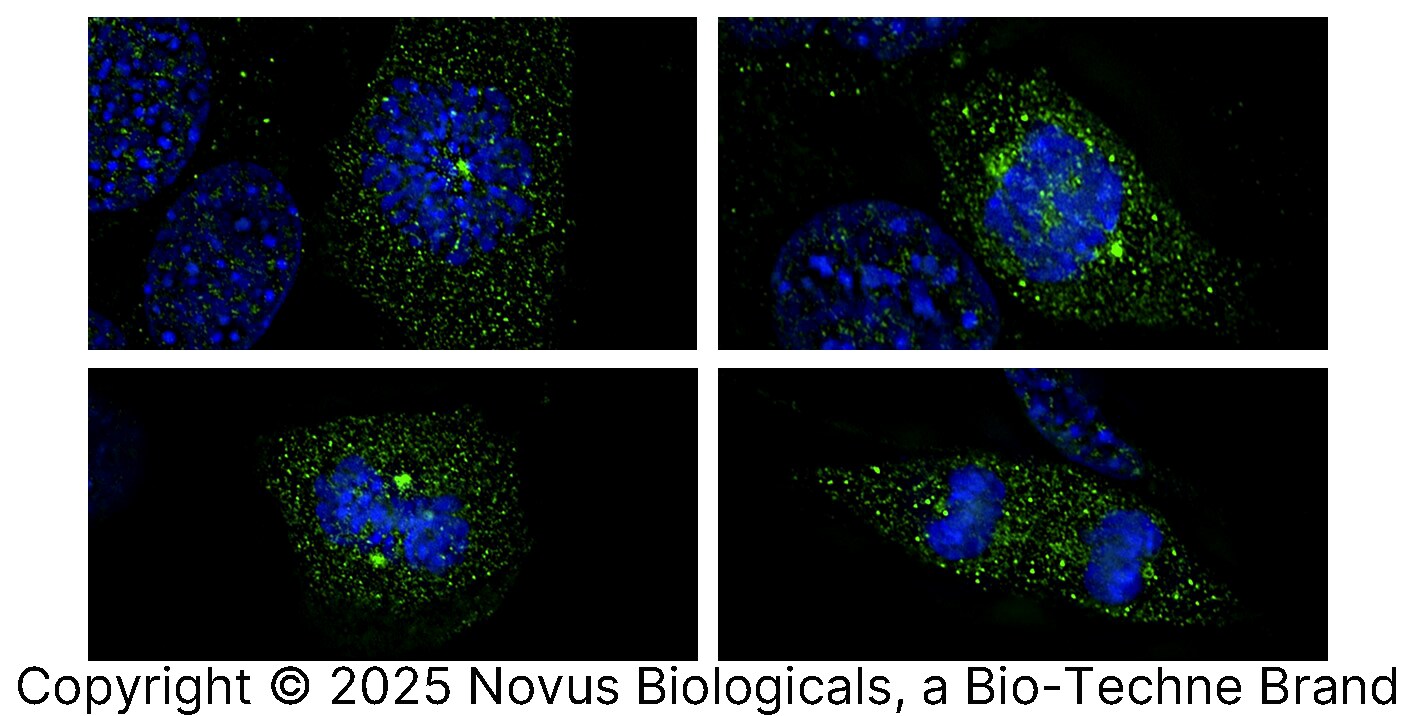 Survivin [p Thr34] Antibody - BSA Free