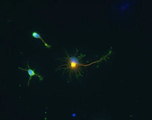 GAD1/GAD67 Antibody Immunocytochemistry/Immunofluorescence: GAD1/GAD67 Antibody [NBP1-02161]