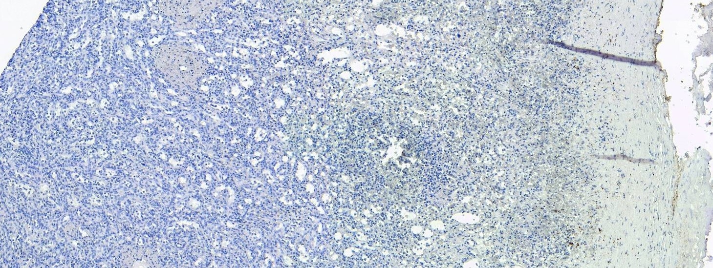 S100A9 Antibody