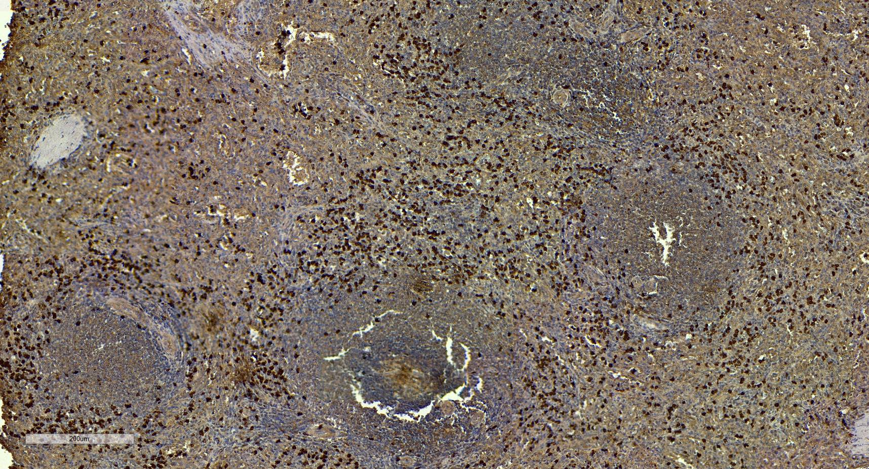 S100A9 Antibody