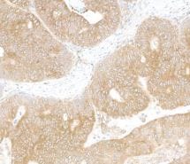 LARP1 Antibody