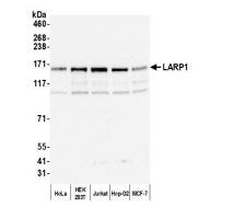 LARP1 Antibody