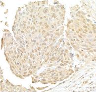 NRIP Antibody
