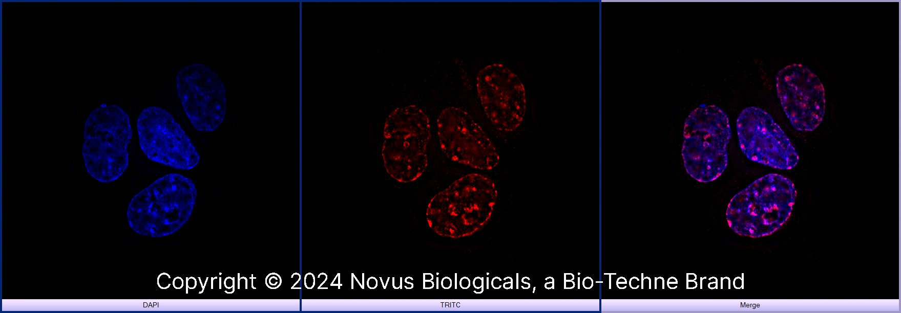 Histone H3 [Trimethyl Lys9] Antibody (6F12-H4)