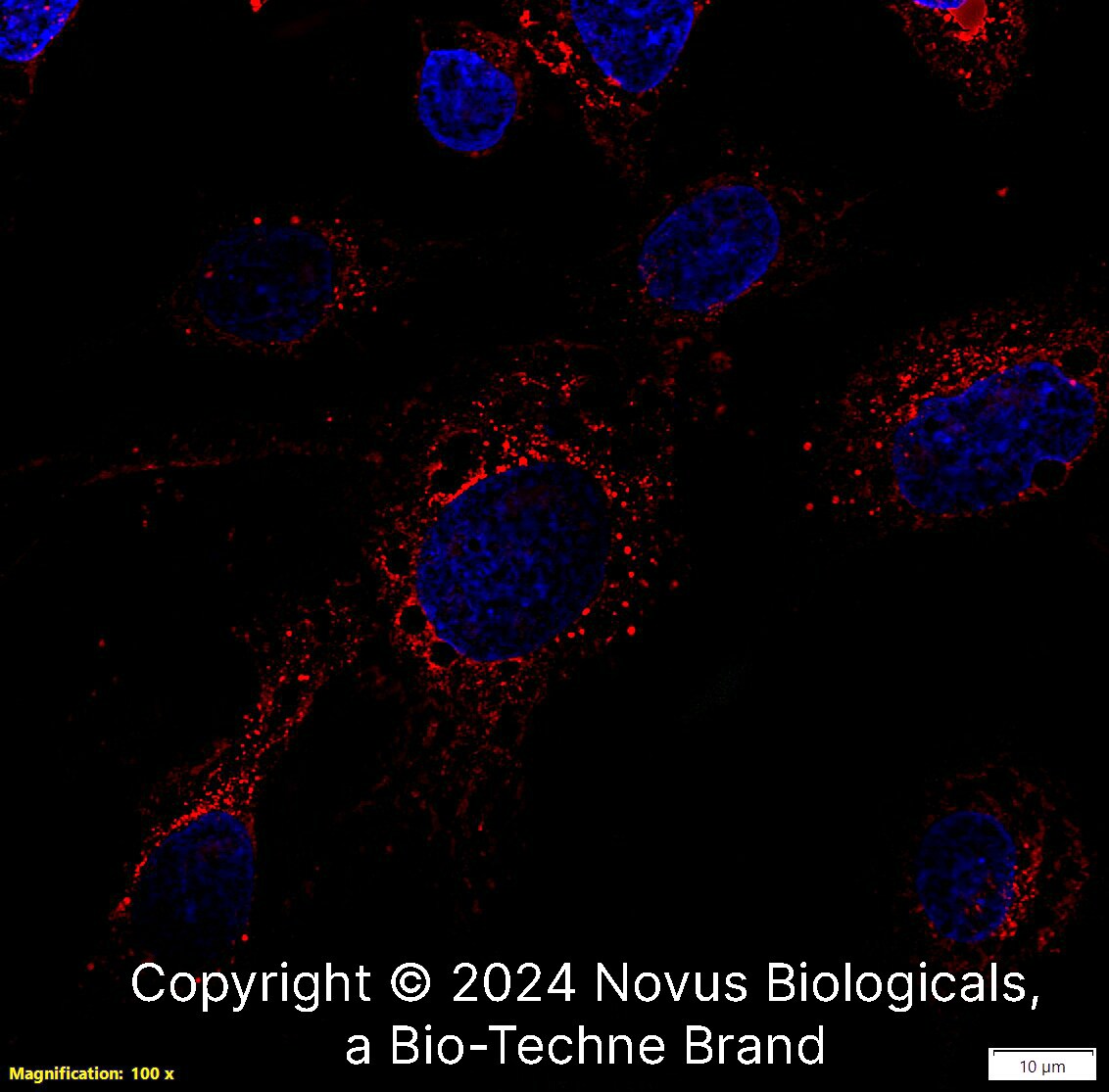 Apolipoprotein E/ApoE Antibody - BSA Free
