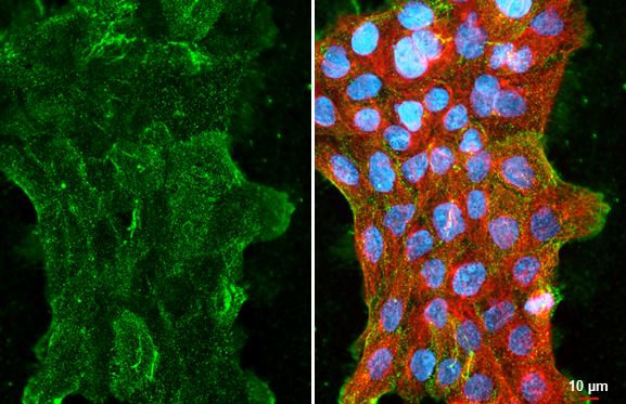 CMTM6 Antibody