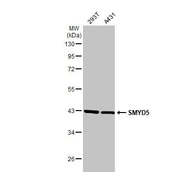 SMYD5 Antibody