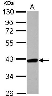 SMYD5 Antibody