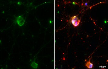 GPER/GPR30 Antibody