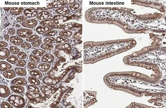 GPER/GPR30 Antibody