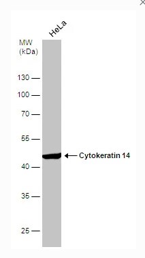 Cytokeratin 14 Antibody