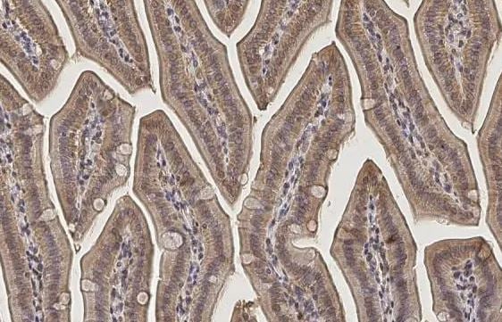 Inorganic Pyrophosphatase/PPA1 Antibody