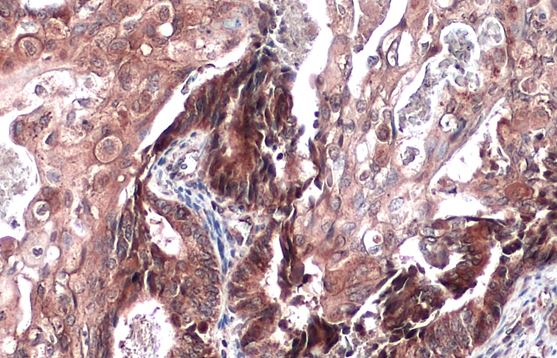 ST3 beta-Gal alpha-2,3-Sialyltransferase 1/ST3GAL1/SIAT4A Antibody