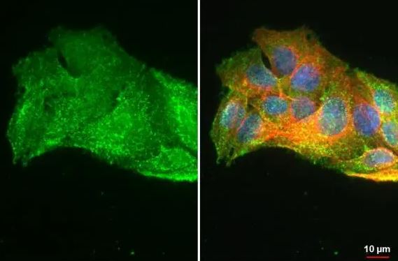 Glutathione Peroxidase 2/GPX2 Antibody