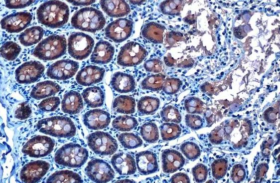Glutathione Peroxidase 2/GPX2 Antibody