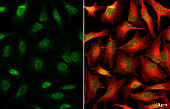 SNRPB Antibody