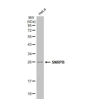 SNRPB Antibody