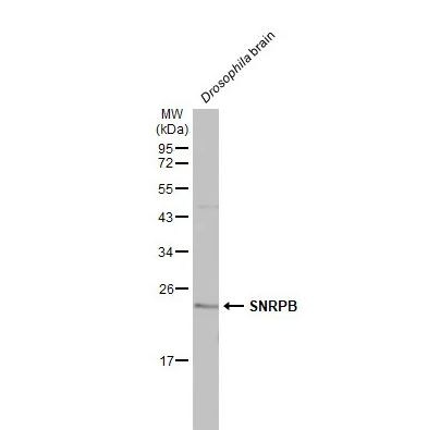 SNRPB Antibody