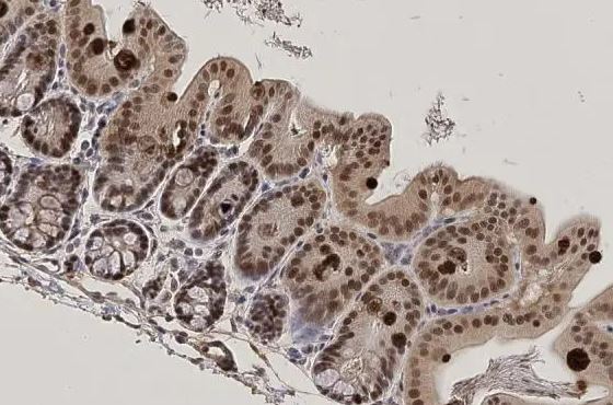KLF5 Antibody