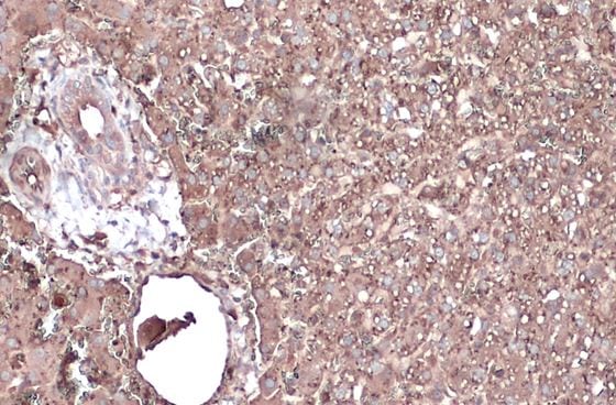 Albumin Antibody