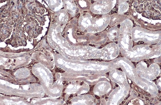 Albumin Antibody