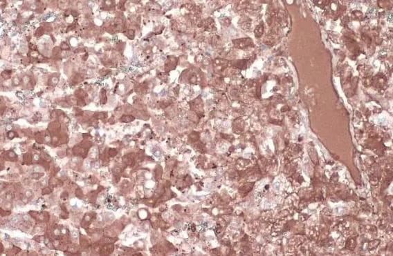 Albumin Antibody