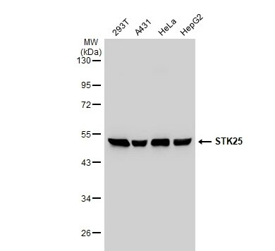 STK25 Antibody
