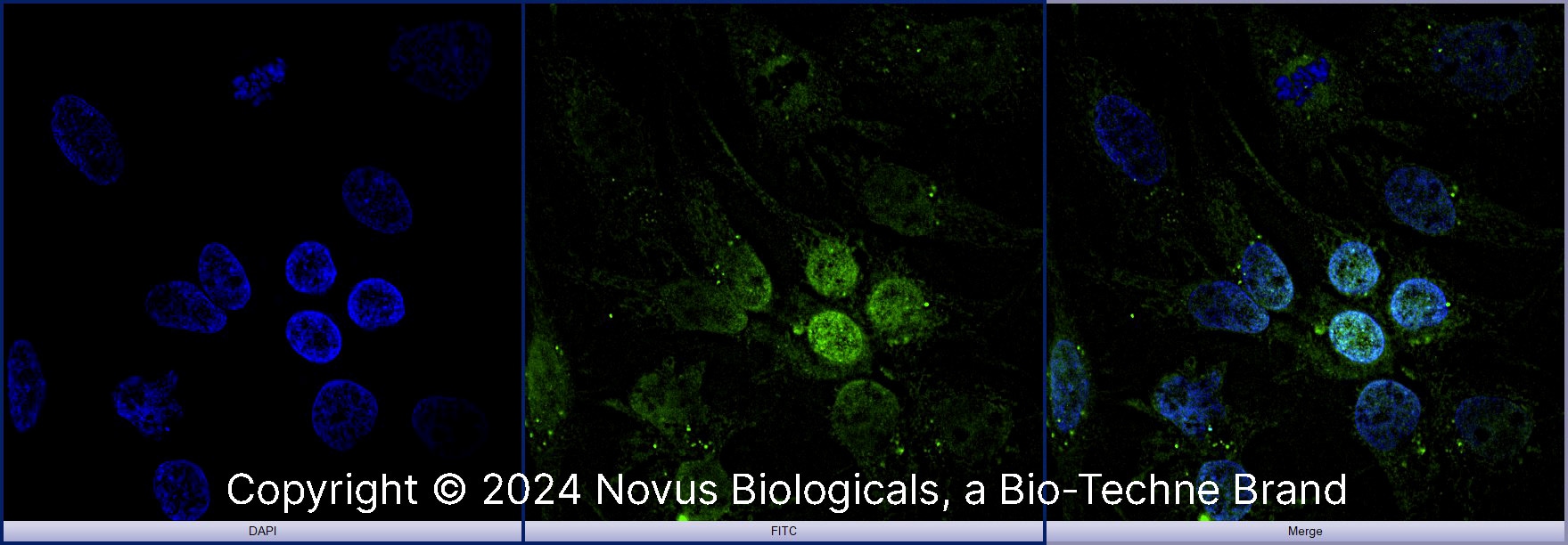 Arginase 1/ARG1/liver Arginase Antibody - BSA Free