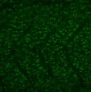 NHP2L1 Antibody NHP2L1 Antibody