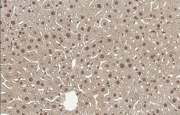 T-box 19 Antibody