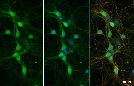 ATP6V1H Antibody