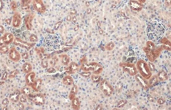 ATP6V1H Antibody