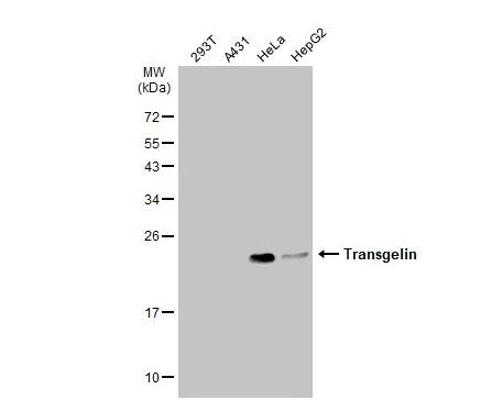 Transgelin/TAGLN/SM22 alpha Antibody
