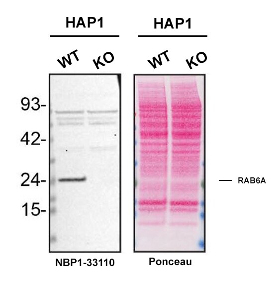 RAB6A Antibody