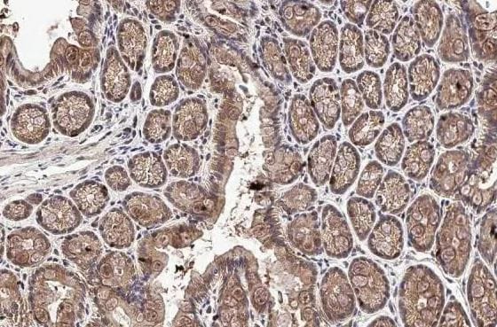 DDR1 Antibody