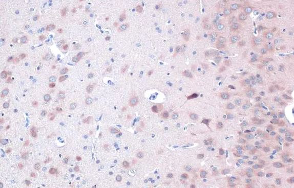 ULK2 Antibody