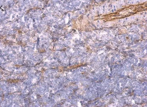 TNFAIP2 Antibody