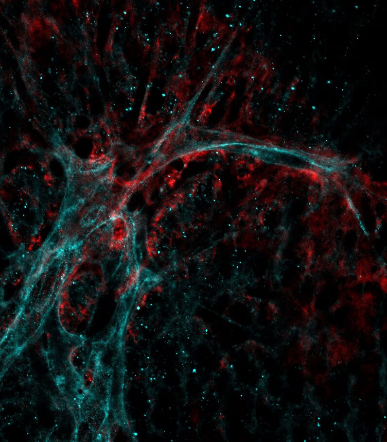Fibrinogen beta chain Antibody