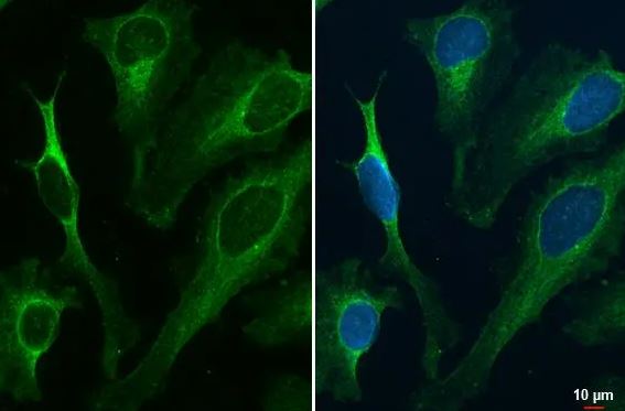 Renin R Antibody