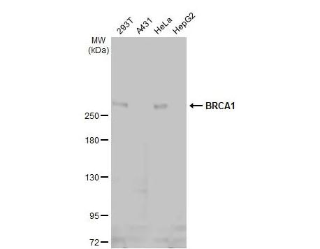 BRCA1 Antibody (8F7)