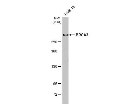BRCA2 Antibody (5F6)