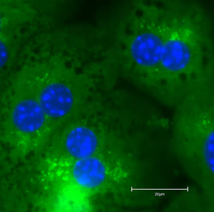 p62/SQSTM1 Antibody - BSA Free