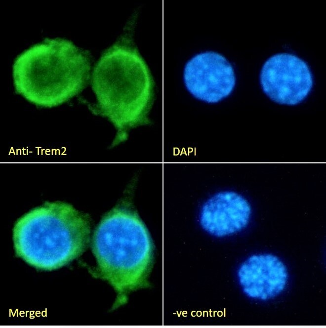 TREM2 Antibody