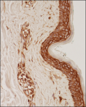 CD44 Antibody (8E2F3) - BSA Free Immunohistochemistry-Paraffin: CD44 Antibody (8E2F3) - BSA Free [NBP1-47386]