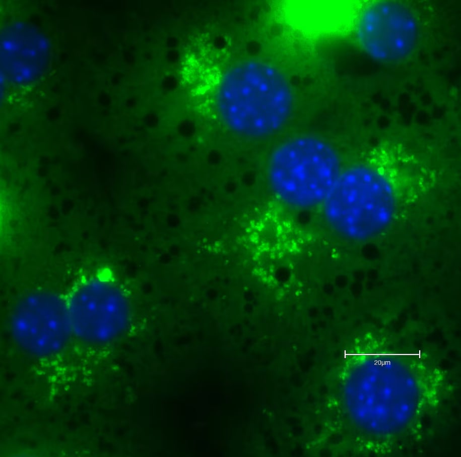 p62/SQSTM1 Antibody - BSA Free