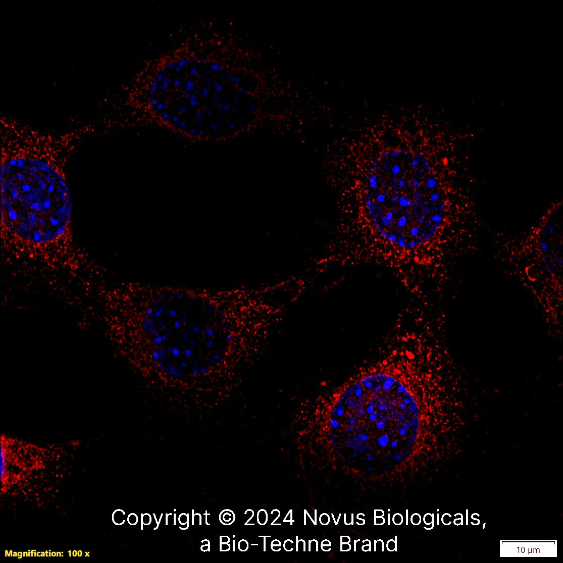 CCR2 Antibody - BSA Free