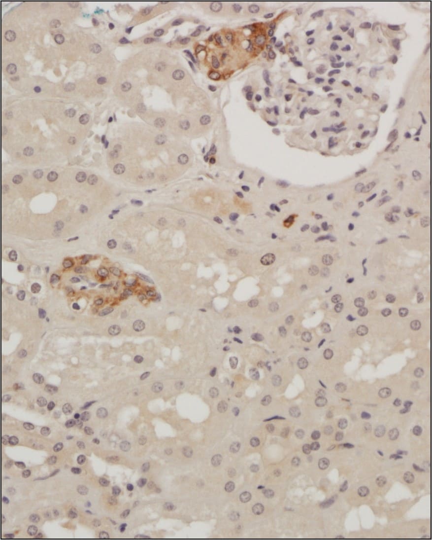 Glut4 Antibody - BSA Free Immunohistochemistry: Glut4 Antibody - BSA Free [NBP1-49533]